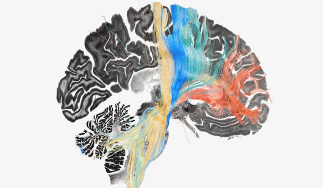 Brain disease-specific streamlines associated with symptom improvement