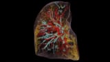 Immagine 3D di un polmone umano